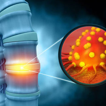 best bone-and-sarcoma-surgen near me