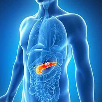 Pancreatic Cancer removal